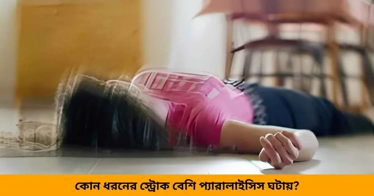 কোন ধরনের স্ট্রোক বেশি প্যারালাইসিস ঘটায়