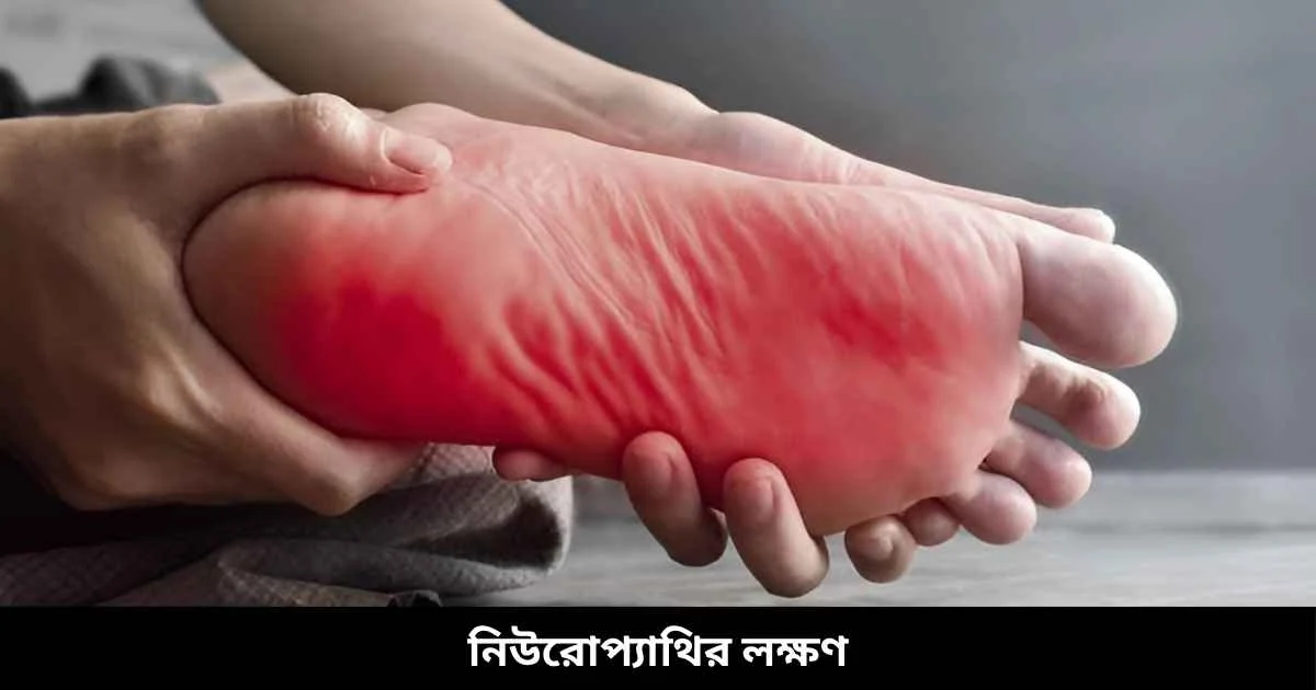 নিউরোপ্যাথির লক্ষণ