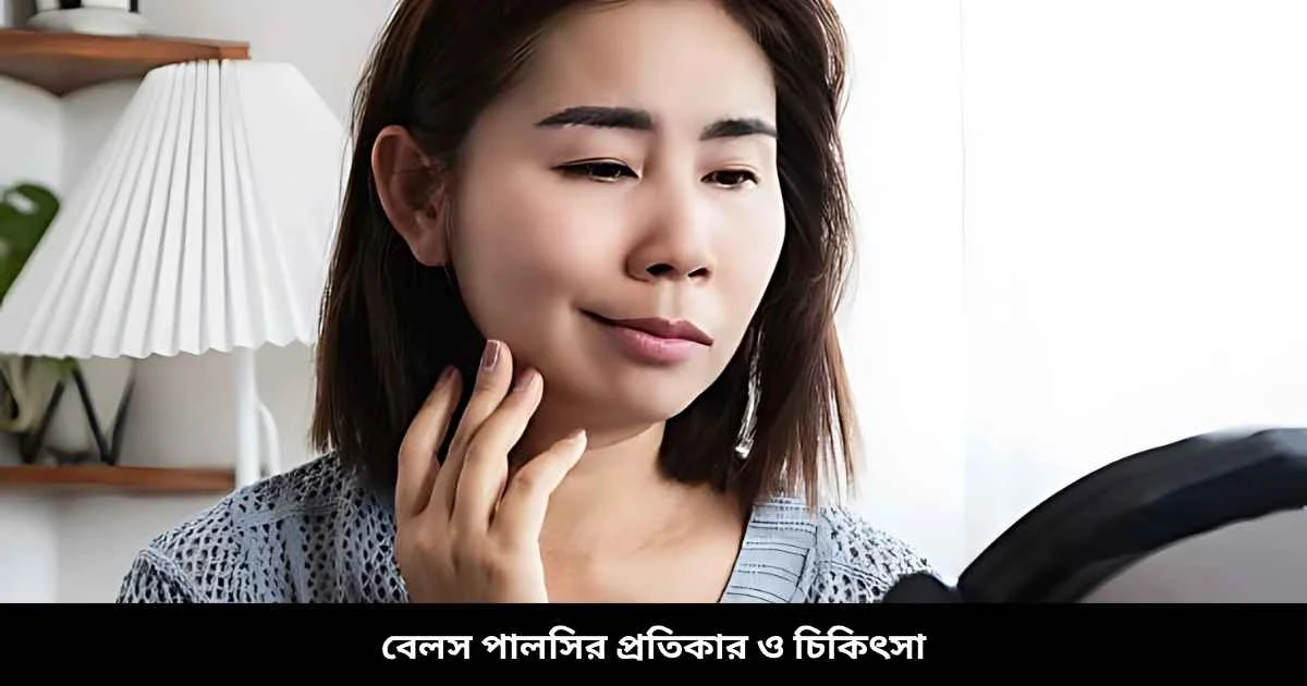 বেলস পালসির প্রতিকার ও চিকিৎসা