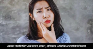 বেলস পালসি কি এর কারণ, লক্ষণ, প্রতিকার ও ফিজিওথেরাপি চিকিৎসা