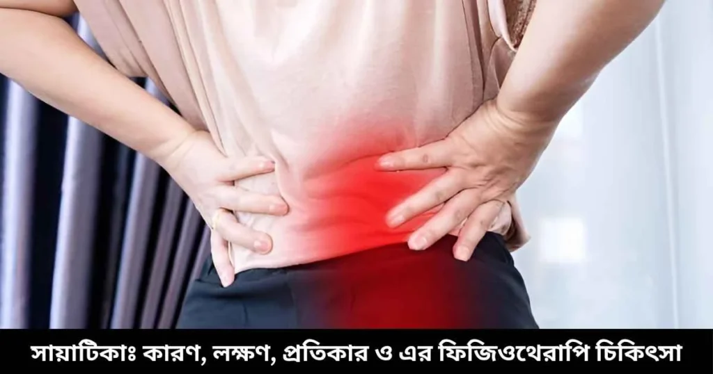 সায়াটিকাঃ কারণ, লক্ষণ, প্রতিকার ও এর ফিজিওথেরাপি চিকিৎসা