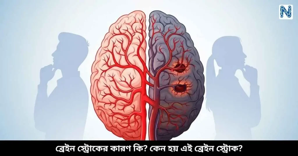 ব্রেইন স্ট্রোকের কারণ কি, কেন হয় এই ব্রেইন স্ট্রোক