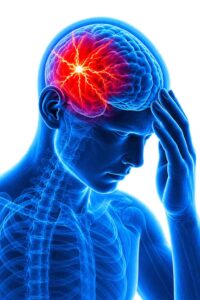 Stroke-Rehabilitation