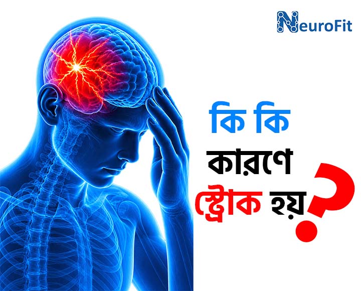 কি কি কারণে স্ট্রোক হয়: জানুন মস্তিষ্কে রক্ত সঞ্চালনের ব্যাঘাতের প্রধান কারণ, ঝুঁকি ও প্রতিরোধের উপায় 2 কি কি কারণে স্ট্রোক হয়