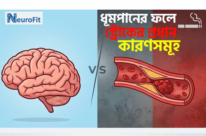 ধূমপানের কারণে কি স্ট্রোক হয়? জেনে নিন প্রধান কারণগুলো 2 ধূমপানের কারণে কি স্ট্রোক হয়?